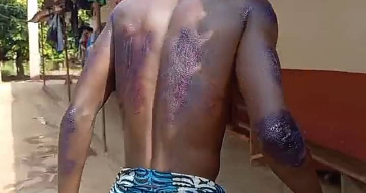 Father allegedly drags 17 year old boy behind tricycle in shocking act of vigilante justice