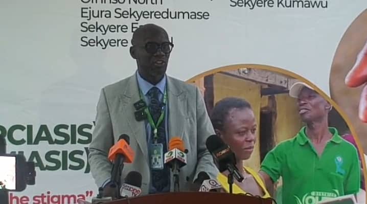 Ashanti Health Directorate begins mass drug administration for river blindness and bilharzia in 9 districts